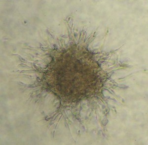 invasion-assay2